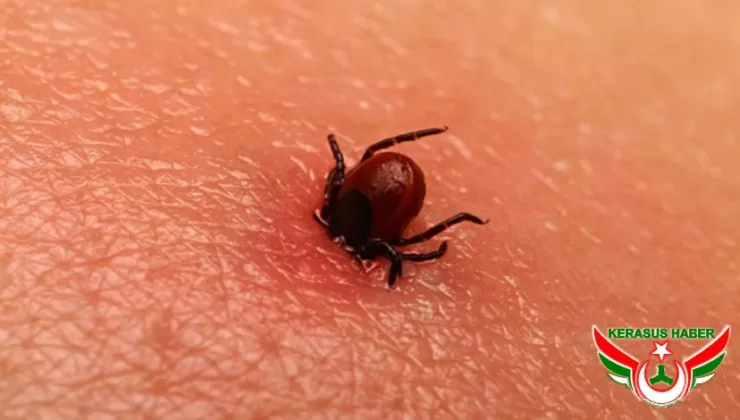 Vücudunuza Kene Yapışmışsa Zarar Vermeyin